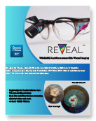 REVEAL FC