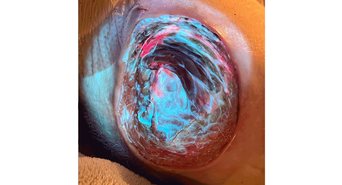 REVEAL Autofluorescence