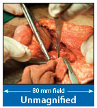 Unmagnified
